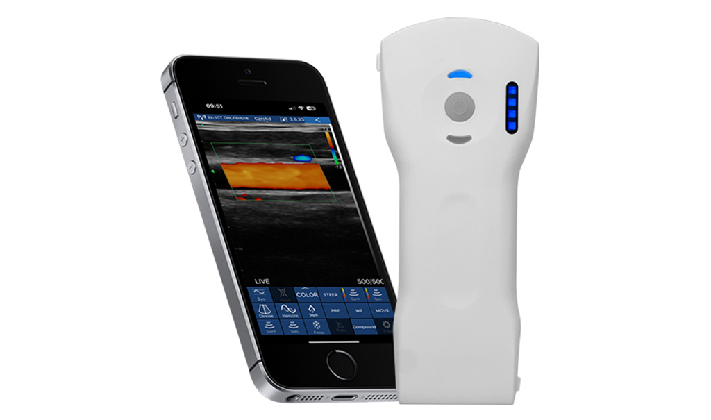 Sonostar CLP8 Dual