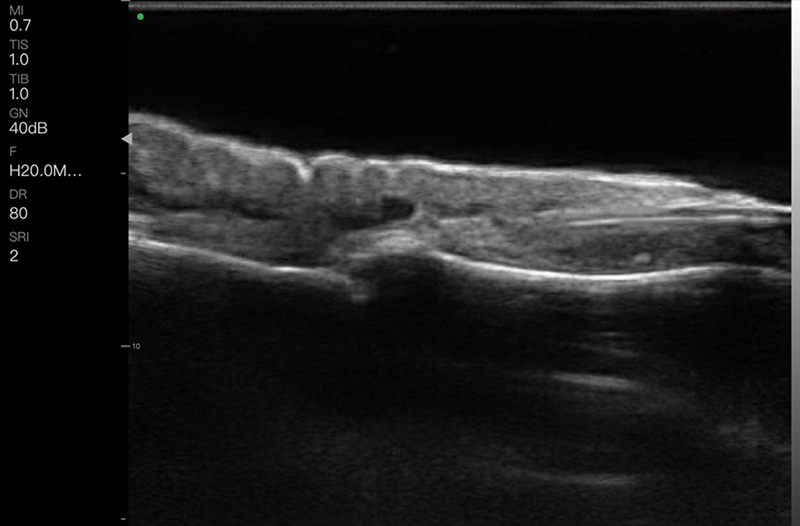 Dermatología alta resolución