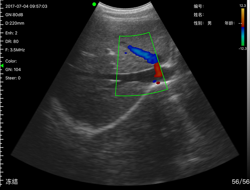 Alta resolución · Abdominal