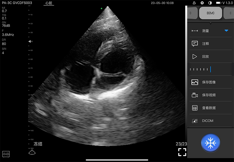 Abdominal · Partes blandas
